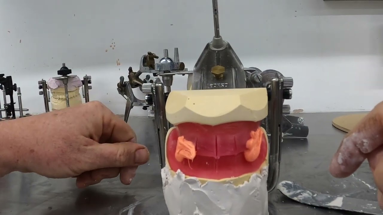 Complete Denture Course: Articulating Models after Occlusal Registration