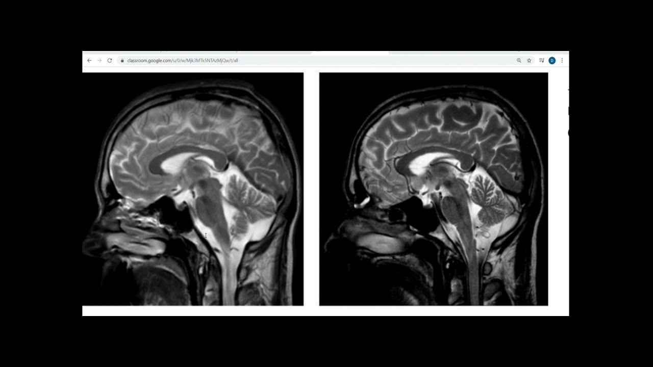 (Resumen) Feedback Calidad de Imagen y Artefactos