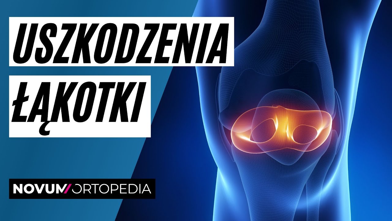 Typowe uszkodzenia łąkotki i sposoby ich leczenia | Novum Ortopedia