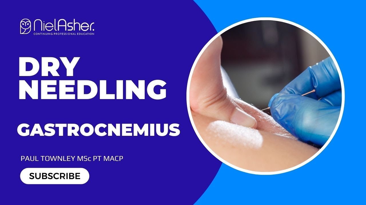 How to Perform Dry Needling on the Gastrocnemius Muscle