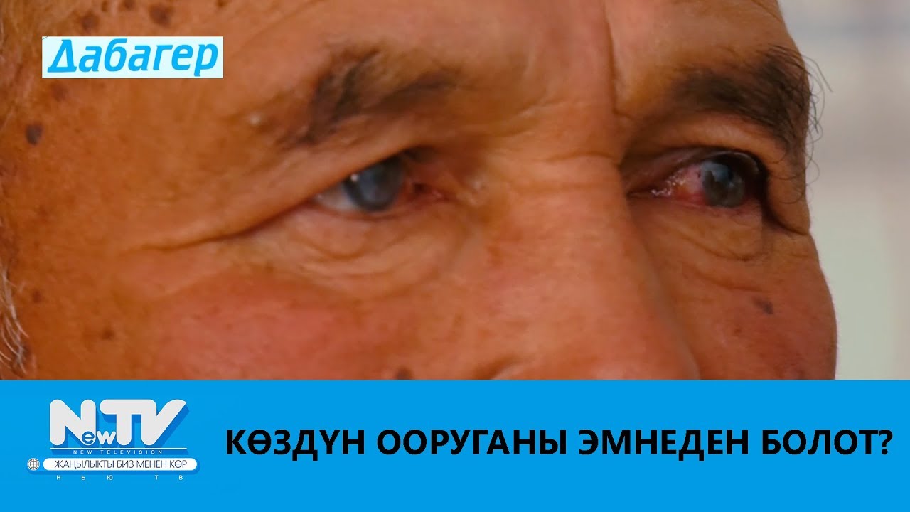 КӨЗДҮН ООРУГАНЫ ЭМНЕДЕН БОЛОТ?\\ДАБАГЕР