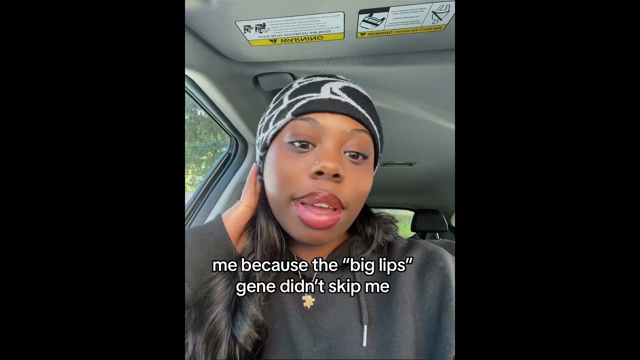 Embracing Natural Beauty: The Big Lips Gene Experience#BigLips #NaturalBeauty #Genetics