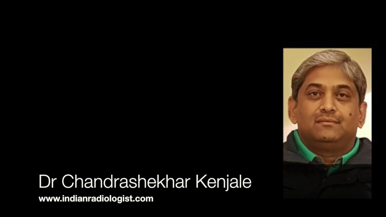 TMT: Fetal Echo: ARSA by Dr Chandrashekhar Kenjale