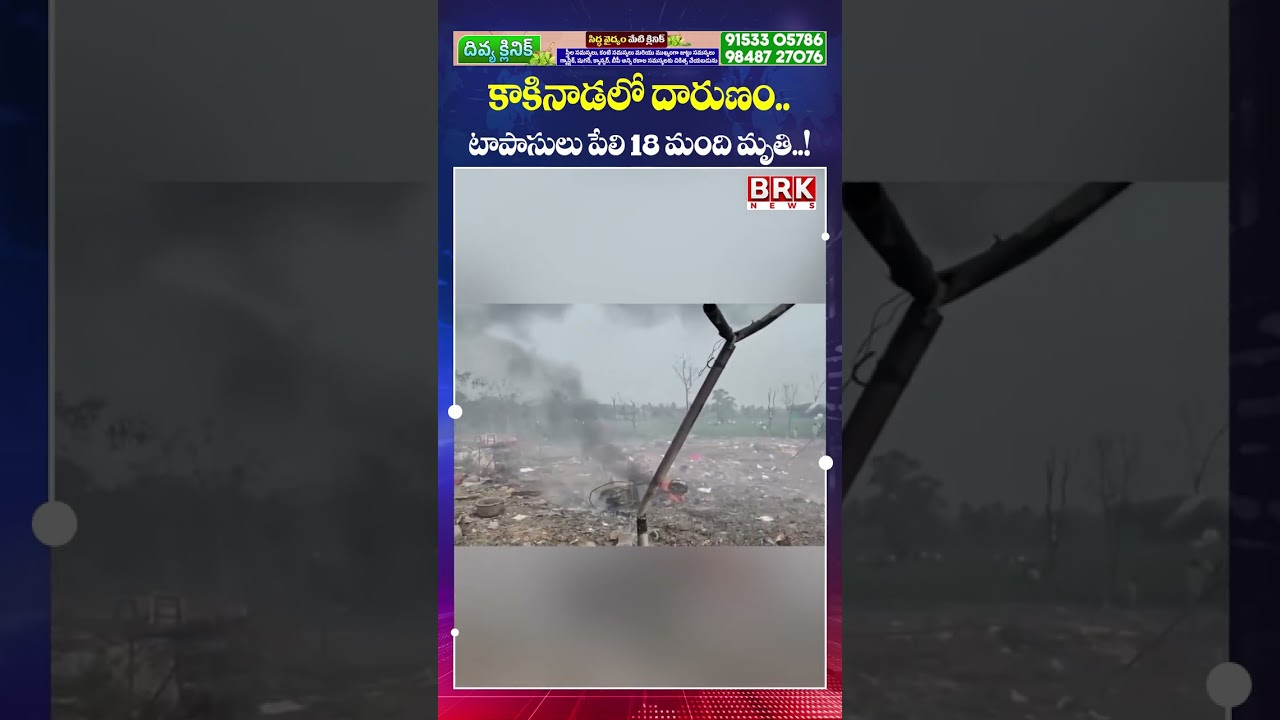 కాకినాడలో దారుణం.. 18 మంది** 😱😱| Fire Accident In Kakinada | BRK News