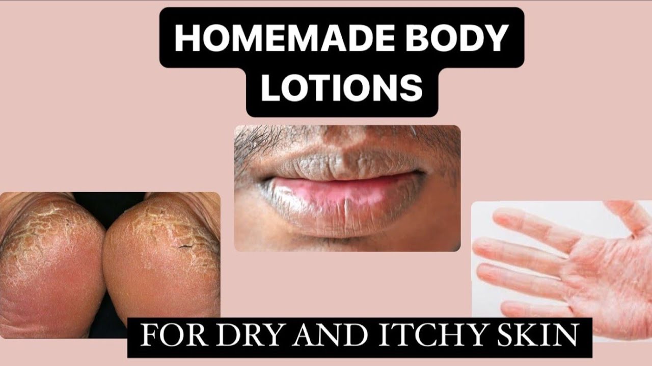 Get Rid Of Dry Skin Naturally /Homemade Body lotion For Dry Skin /Lips/रूखी त्वचा को कैसे रोकें?