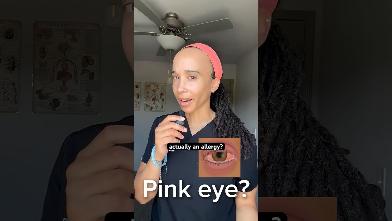 Is Your Pink Eye Actually an Allergy?