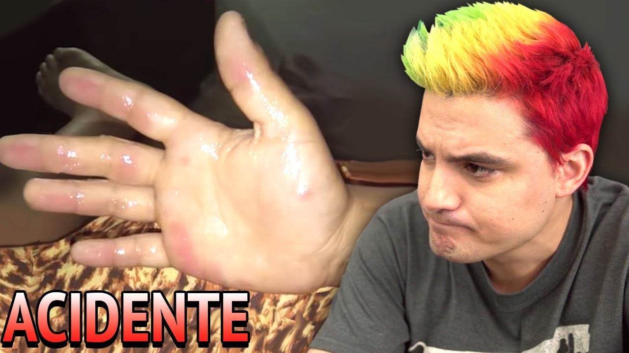 CRIAN&Ccedil;A SOFREU ACIDENTE, CULPA DO FELIPE NETO [+10]