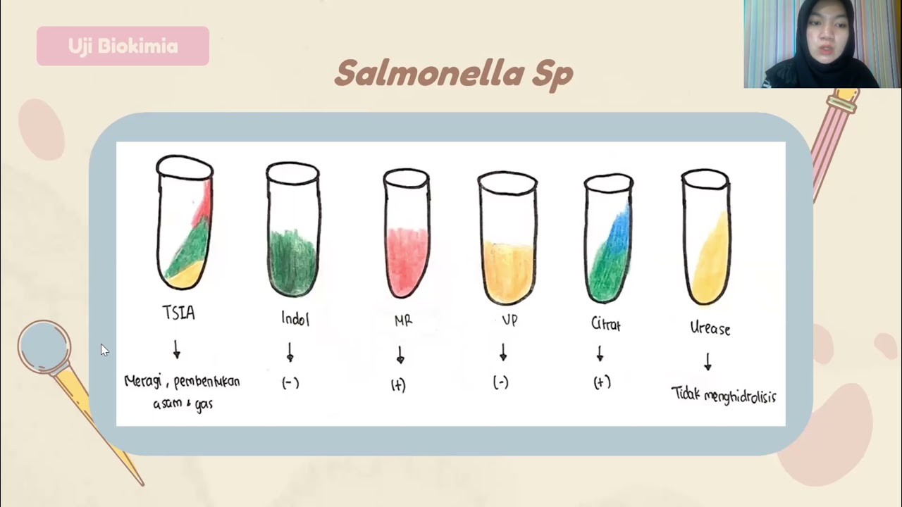 Salmonella sp & Shigella Sp