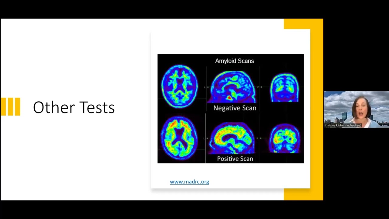 After a Diagnosis of Dementia&mdash;Then What? Creating a Post Diagnosis Game Plan