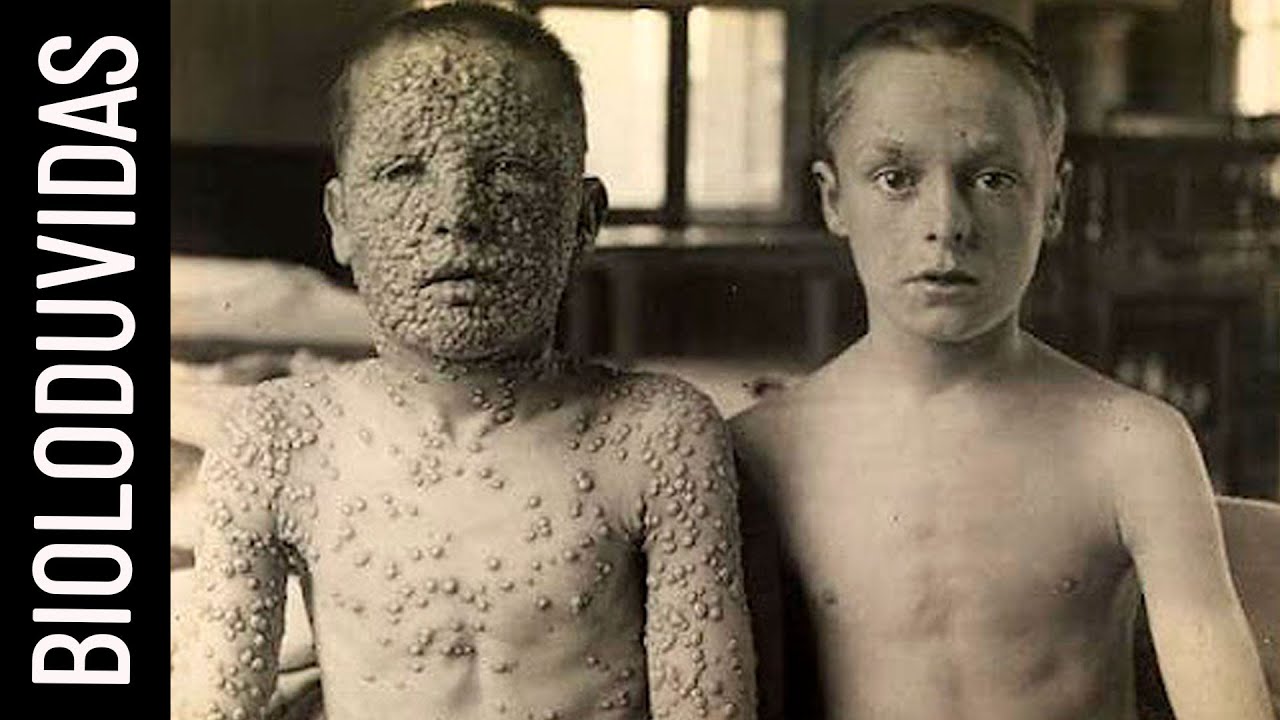 3 vacinas que SALVARAM a HUMANIDADE - AULA DE BIOLOGIA│V&Iacute;DEO SOBRE IMPORT&Acirc;NCIA DAS VACINAS
