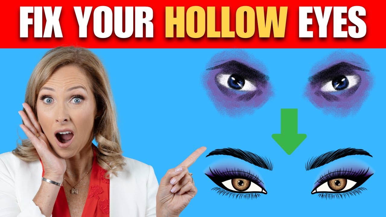 Hollow Eyes? Here's How To Fix Them | Dr. Janine