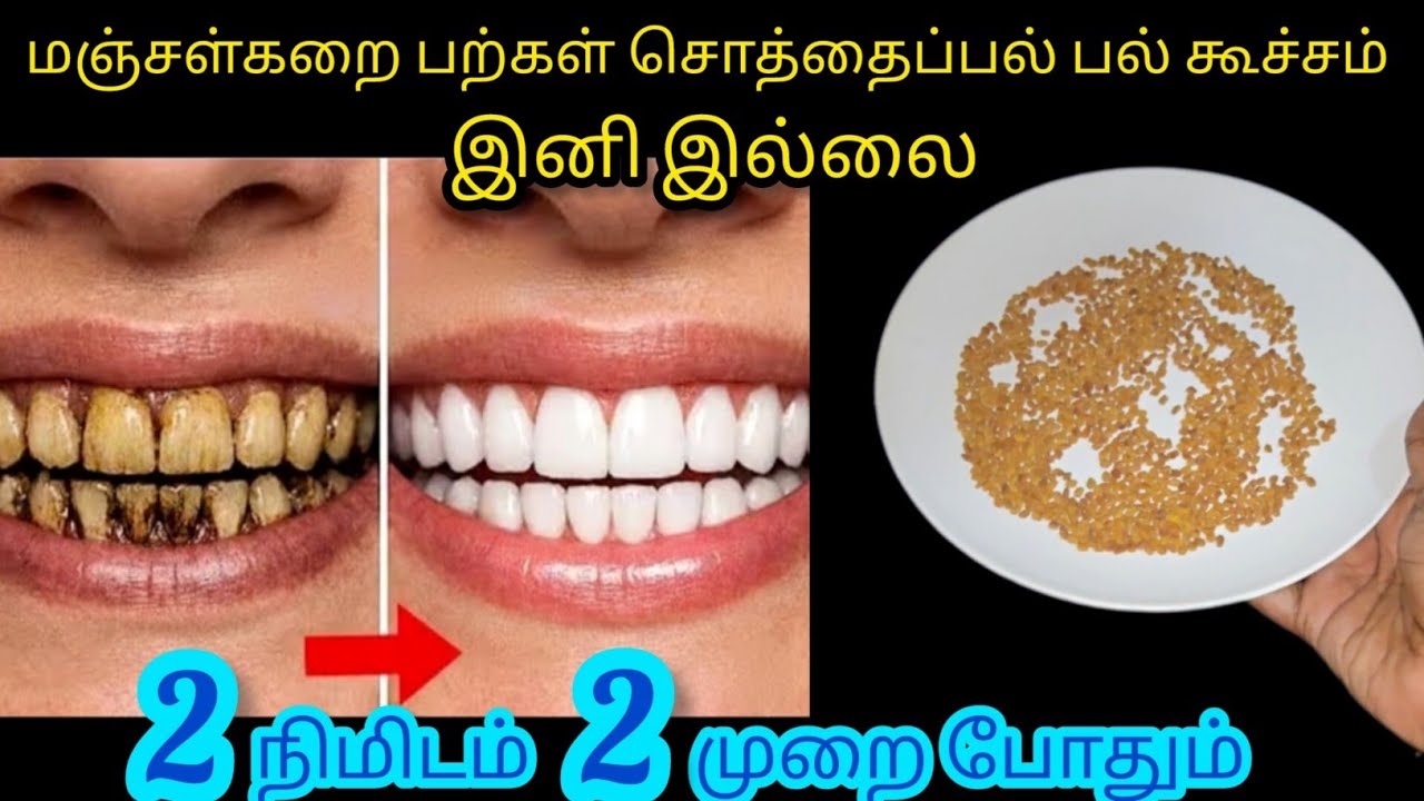 பளபள மினு மினு னு பற்கள் எப்பவும் ஜொலிக்க இத செய்ங்க/Kitchentips/