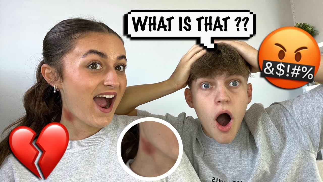 HICKEY PRANK On My Boyfriend!! *He Leaves*