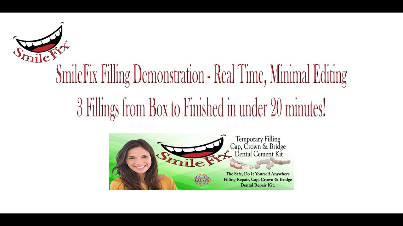 SmileFix Filling Demonstration - Real Time, Minimum Editing - 3 Fillings in under 20 Minutes!