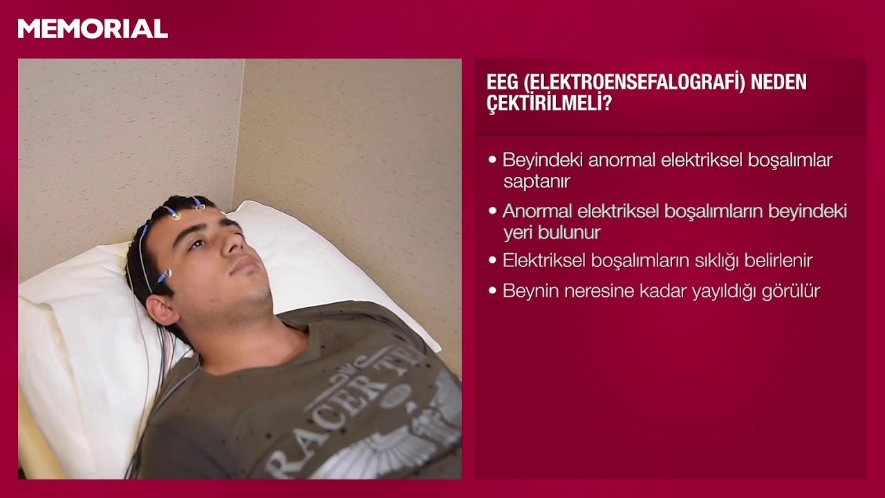 EEG (elektroensefalografi) nedir? - Prof. Dr. Yavuz G&uuml;rer (&Ccedil;ocuk N&ouml;roloji Uz.)