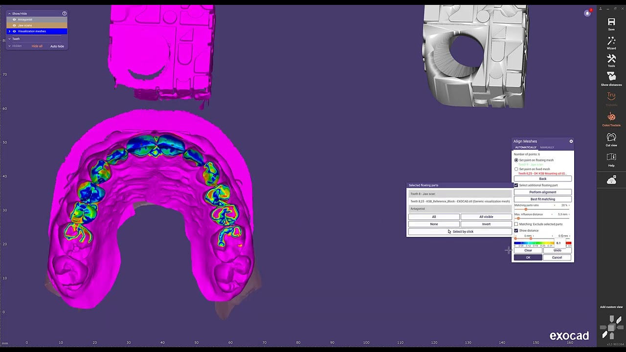 Kois Scan Body (KSB) Workflow exocad 3.2
