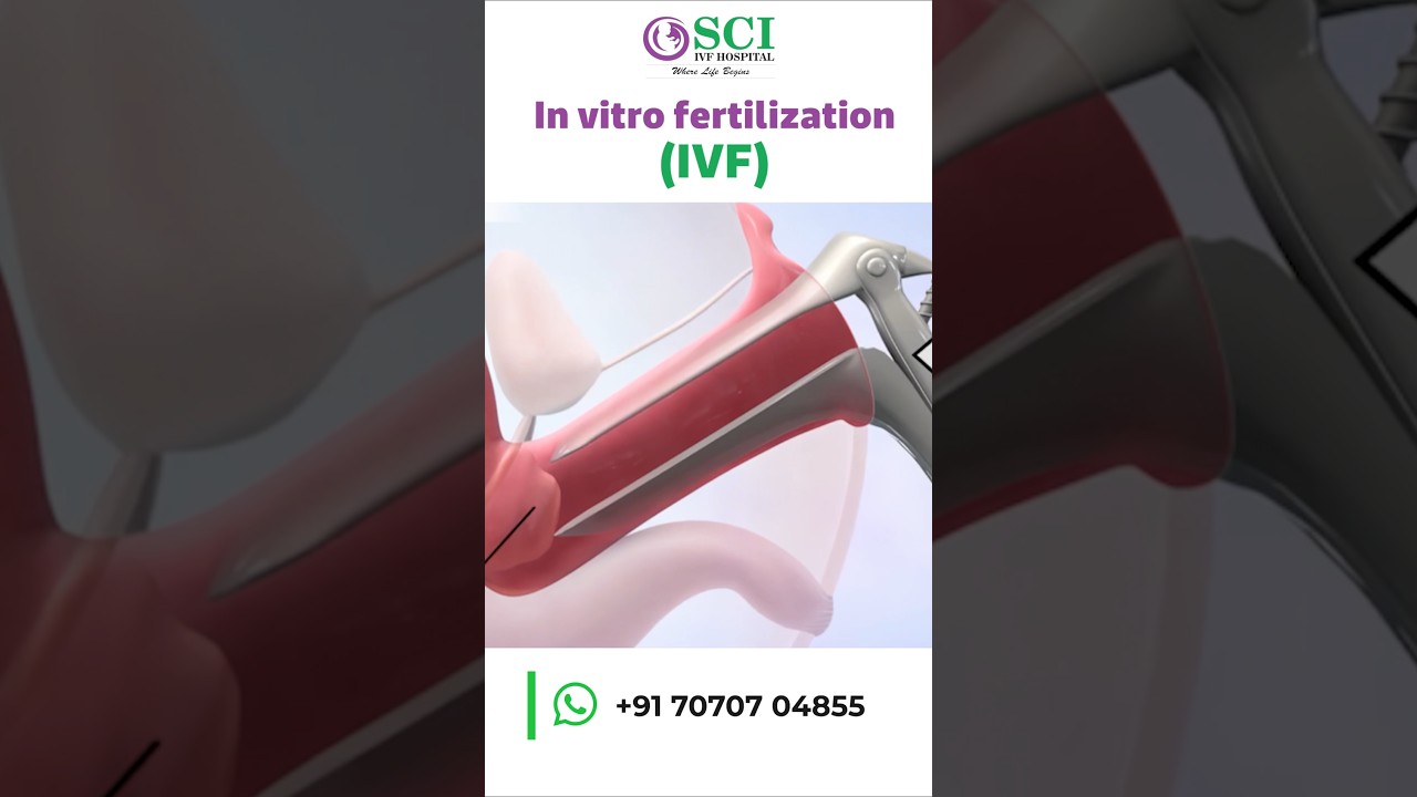 IVF Step-by-Step&hellip; Aise Hota Hai Baby Create! I Animation Reel 👶 #ivfjourney #stepbystep