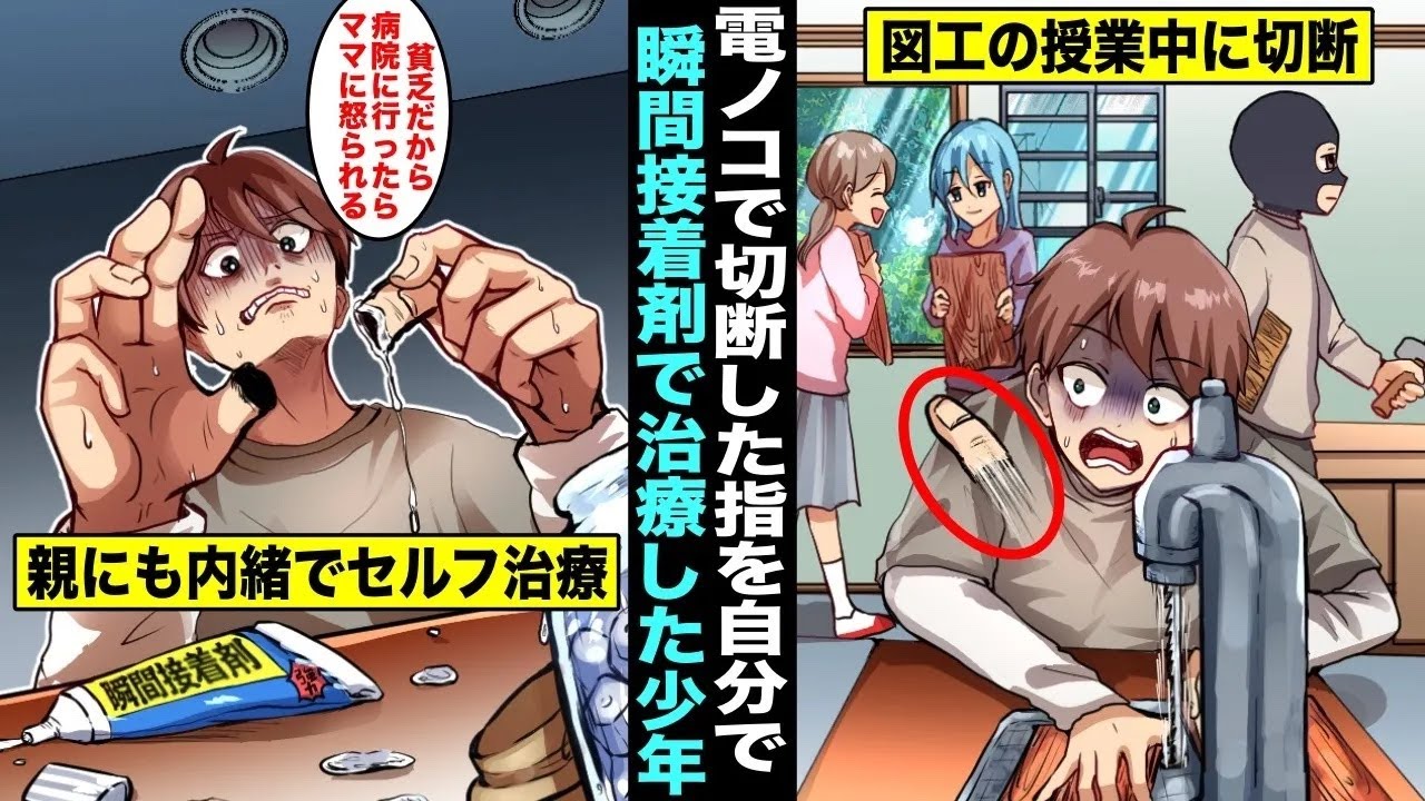 【漫画】図工の授業中に電動ノコギリで親指を切断してしまったが貧乏で病院に行ったらお金がかかってママに怒られると思った僕は怪我を隠すことに…僕はこっそり瞬間接着剤でくっ付けたが・・・【総集編】