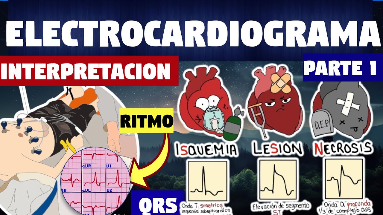 TODO SOBRE EKG | ISQUEMIA, LESION, INFARTO AGUDO |(Parte 1)