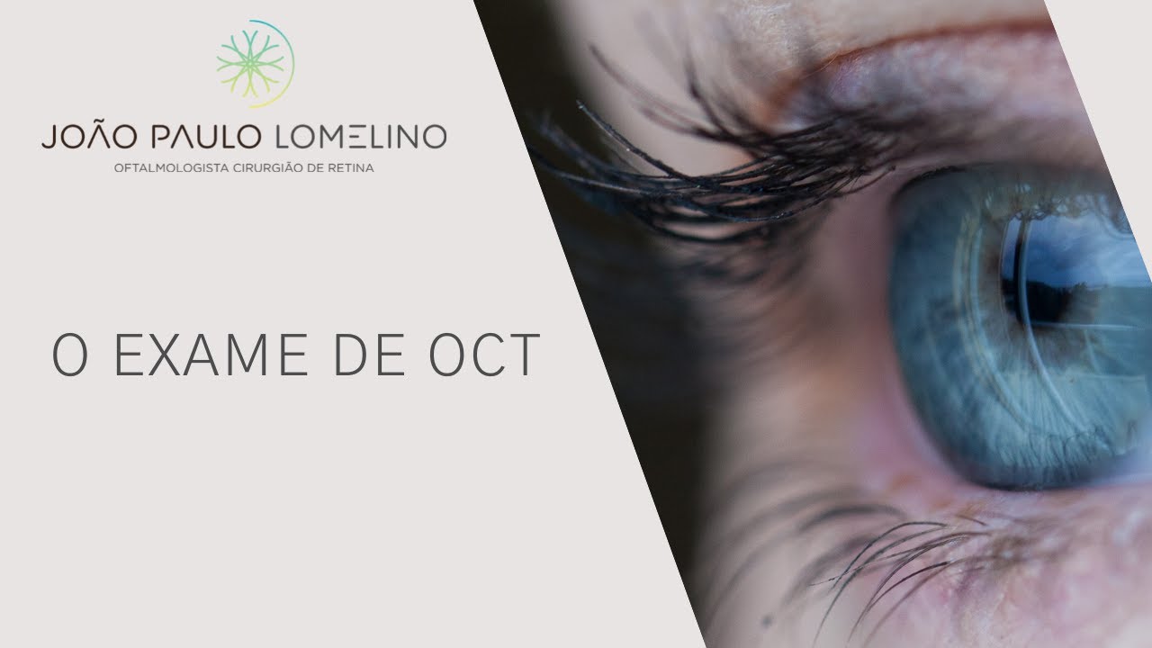 O exame de OCT | Dr. João Paulo Lomelino