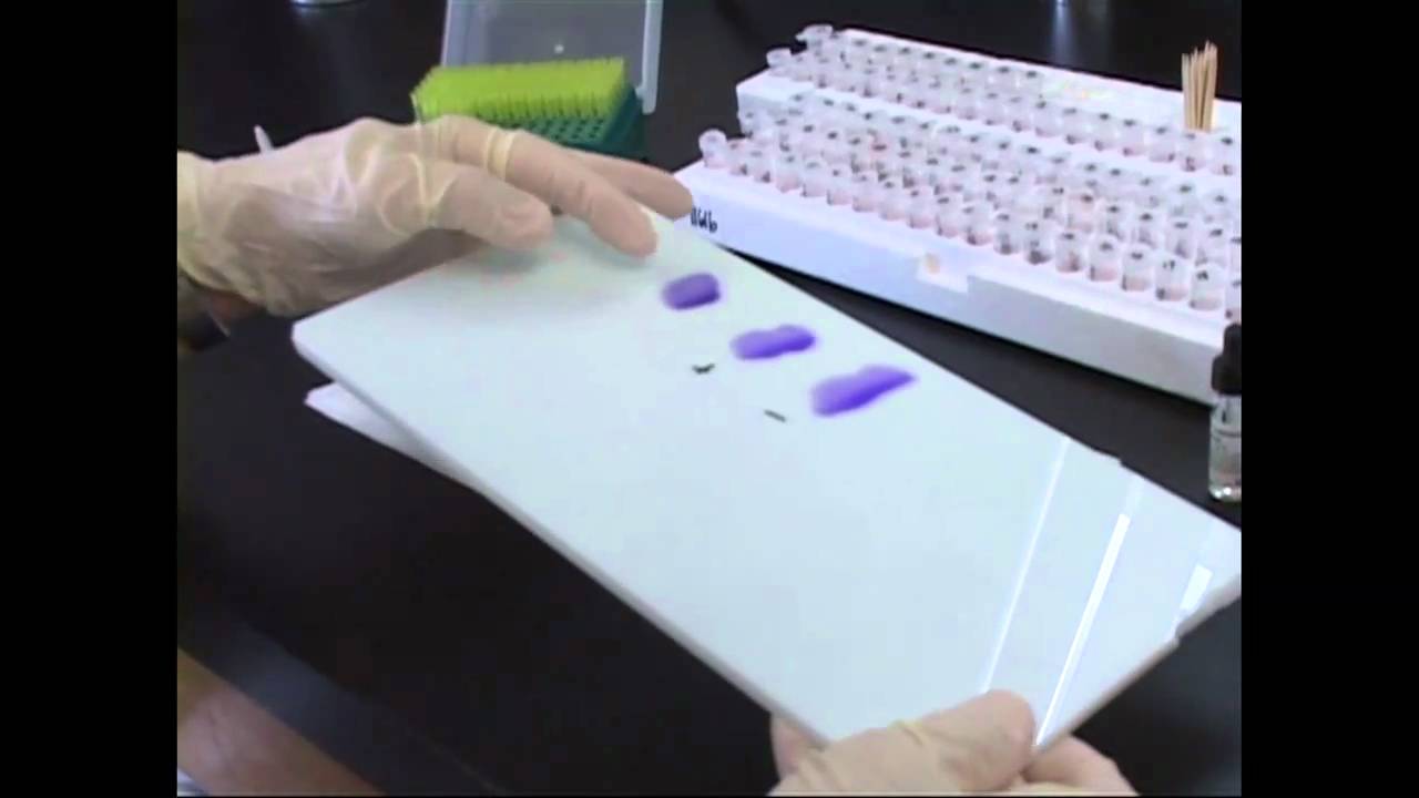 Testing Eggs for Salmonella at UMaine