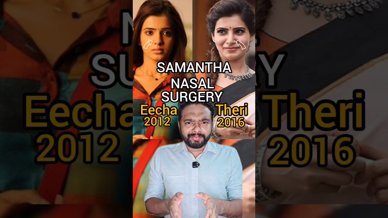 samantha nose surgery and smile correction #arogyam #dentalcare  #tamilmovie #samantha
