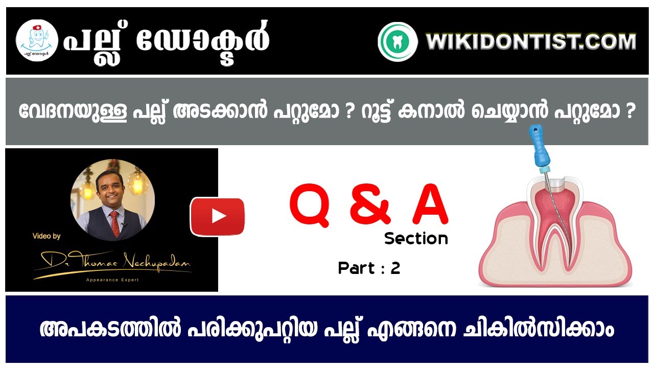 ചോദ്യങ്ങൾക്കുള്ള ഉത്തരം ... Part 2 , വേദനയുള്ള പല്ല് അടക്കാൻ പറ്റുമോ ? റൂട്ട് കനാൽ ചെയ്യാൻ പറ്റുമോ ?