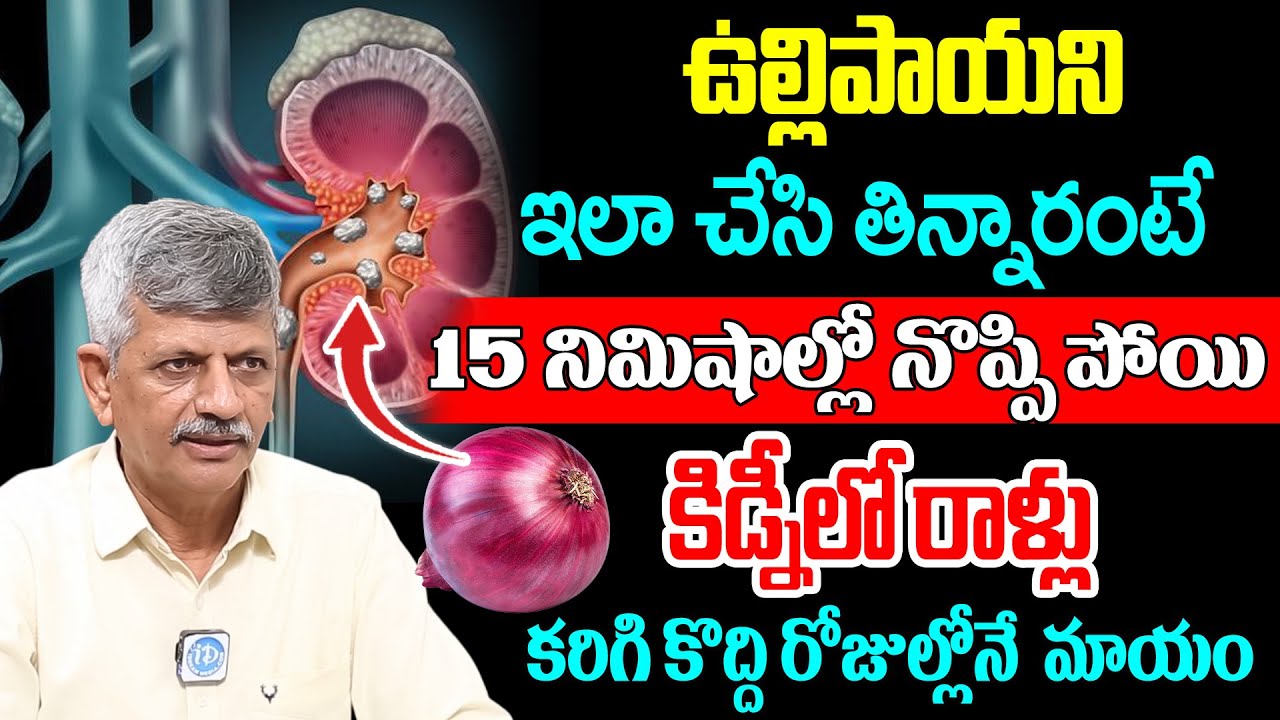 Anjaneya Raju | ఉల్లిపాయని ఇలా తిన్నారంటే కిడ్నీలో రాళ్లు కొద్ది రోజుల్లోనే మాయం | iD Health Focus