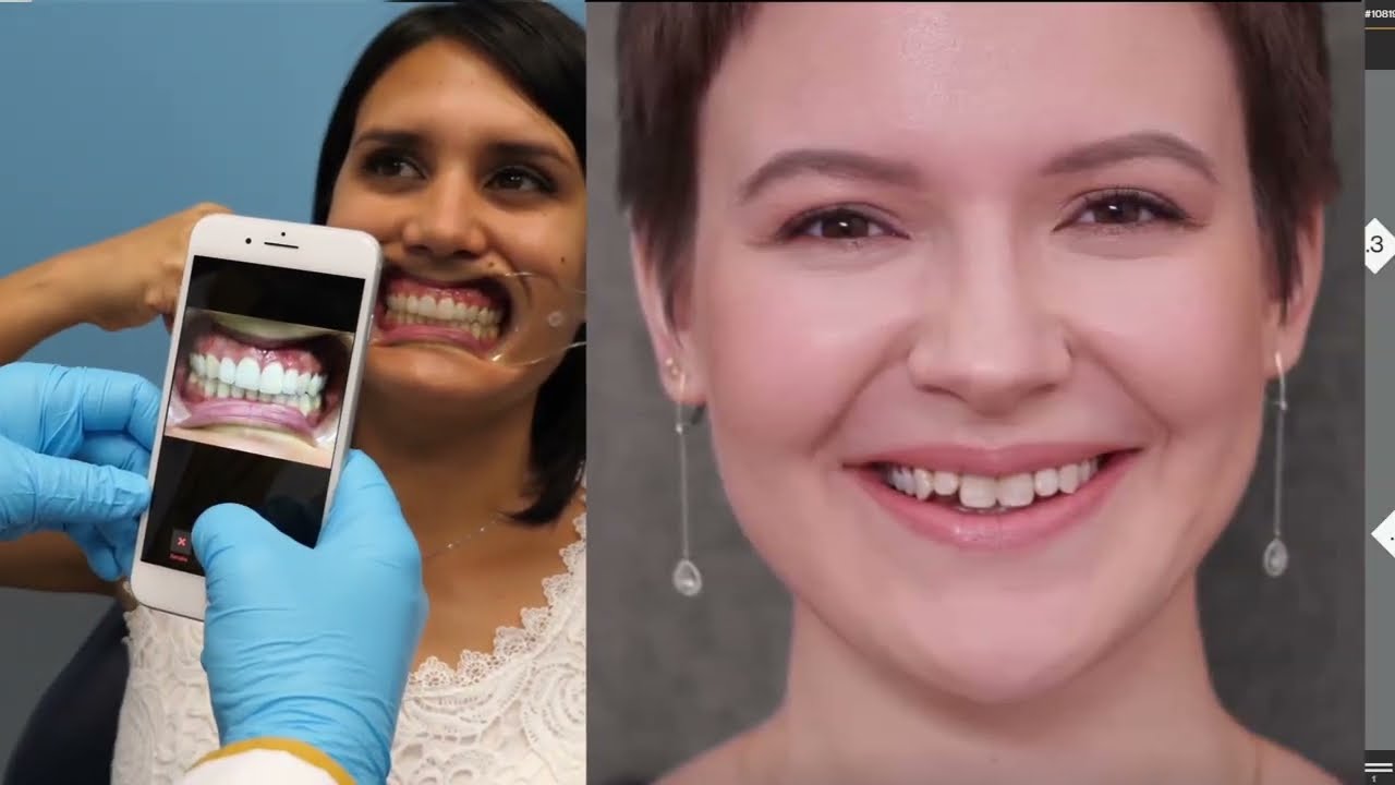 ClinCheck Pro 6.0 for Better Visualization & Flexibility | Align Technology Invisalign®
