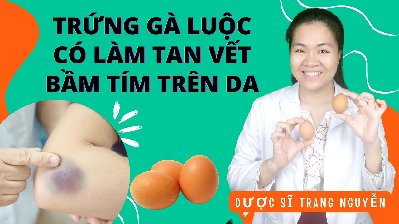 Sai lầm khi lăn trứng gà luộc để giúp tan vết bầm tím trên da
