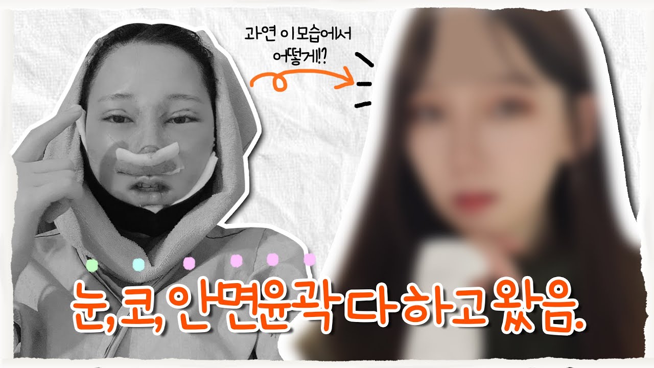 [쀼지 Vlog] 내 모습을 내가 어색해할 정도😏 마지막 눈 재수술, 코성형, 안면윤곽 3개월차 리얼 셀프캠까지😎  [쀼]