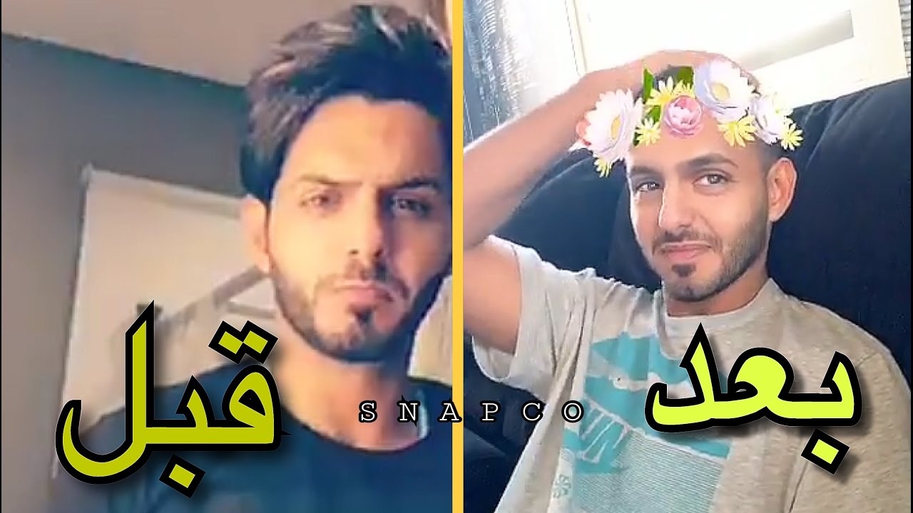 حمود الفايز يمزح مع بدر آل زيدان بعد ماحلق شعره بسبب مرض والدته بسرطان الثدي