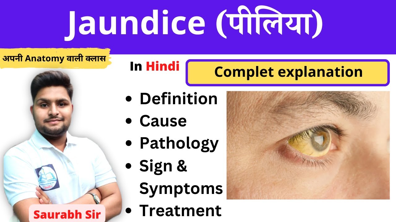 Jaundice ||पीलिया || medical surgical nursing || For Bsc Nursing and GNM and medical students