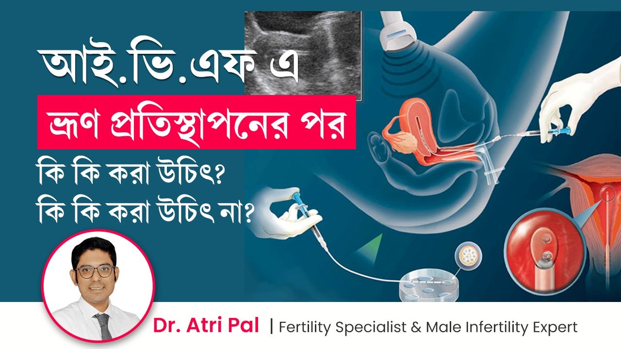 আইভিএফ এ ভ্রূণ প্রতিস্থাপনের পর কি করণীয়? What should do or avoid after embryo transfer in IVF