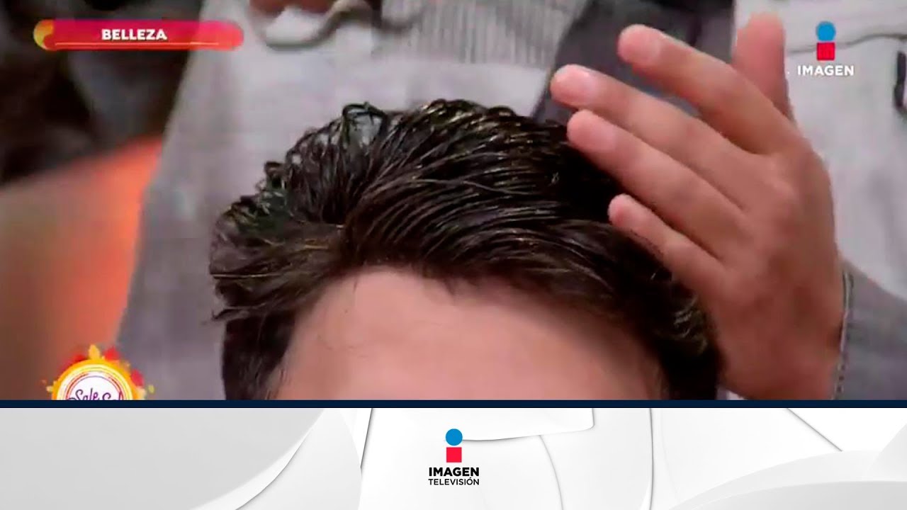 ¿Sufres de alopecia? ¡Conoce esta solución! | Sale el Sol