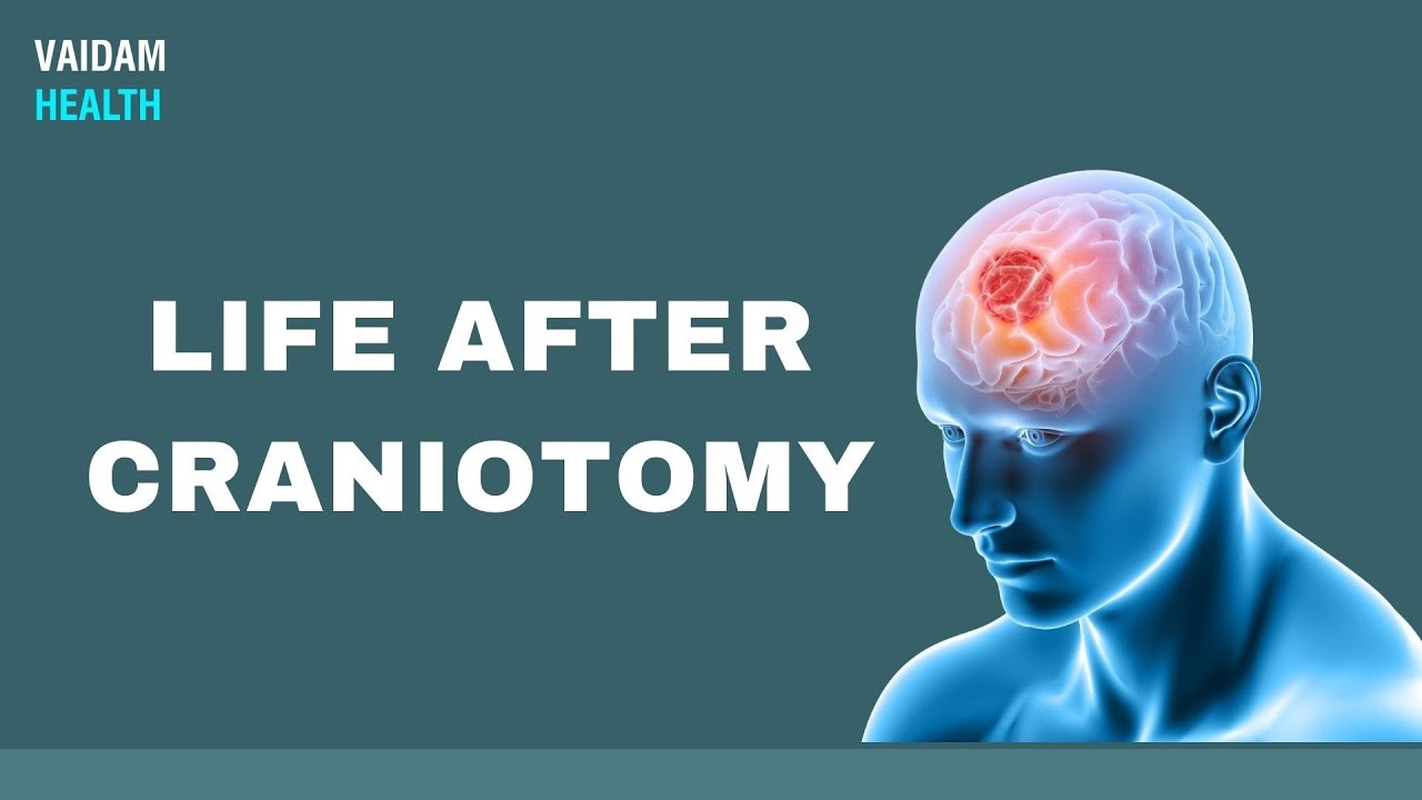 Life After Craniotomy