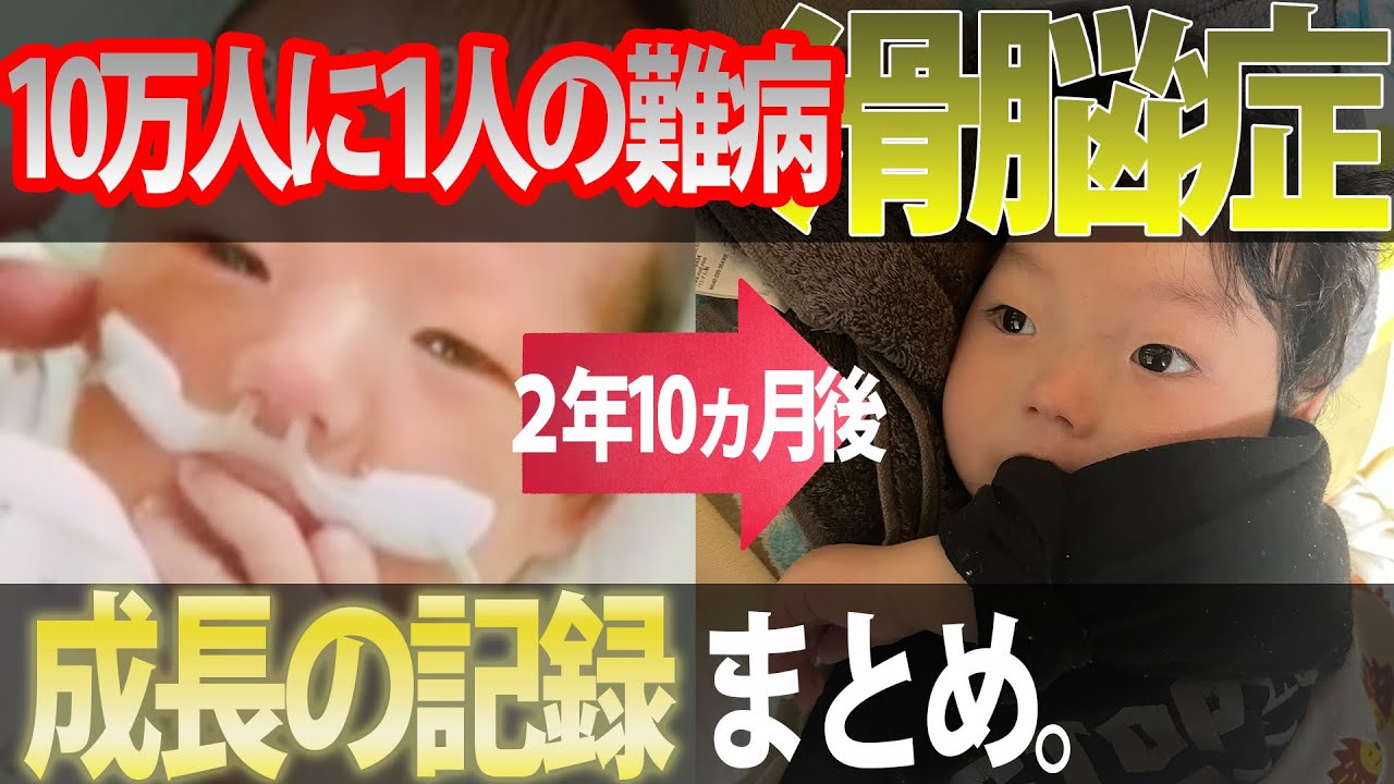 【闘病の日々】一歩ずつ乗り越えて...。誕生から現在までの道のりを詳しく紹介します。