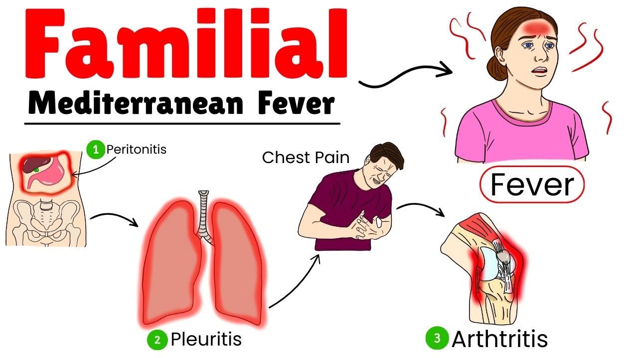 Familial Mediterranean Fever Made Simple &mdash; Pathophysiology and Clinical Features