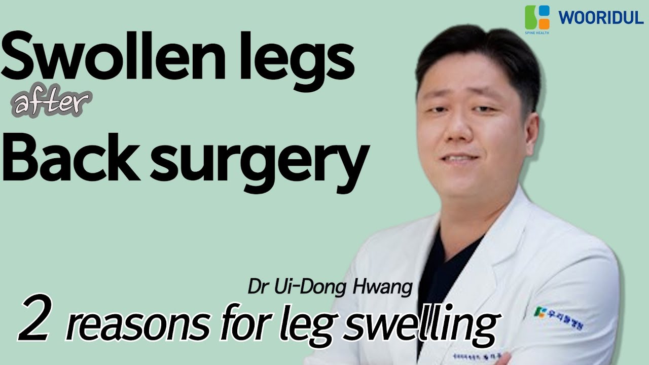 If you are  suffer from swollen legs after back surgery/2 reasons for that