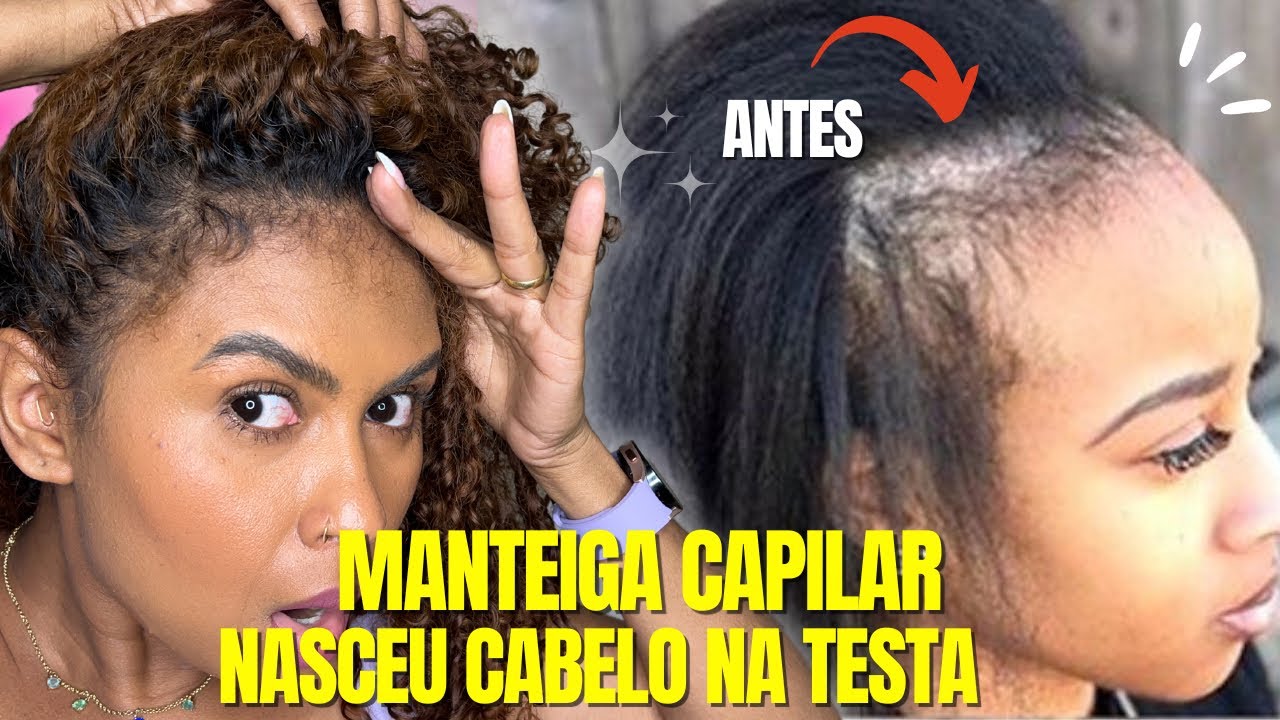 ESQUEÇA OS CABELOS GRISALHOS E A CALVÍCIE! APENAS INGREDIENTES FORTES E SEU CABELO CRESCERÁ RÁPIDO
