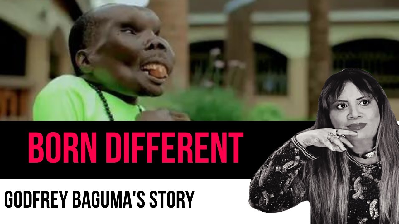 Godfrey Baguma - The Ugliest Man in the World