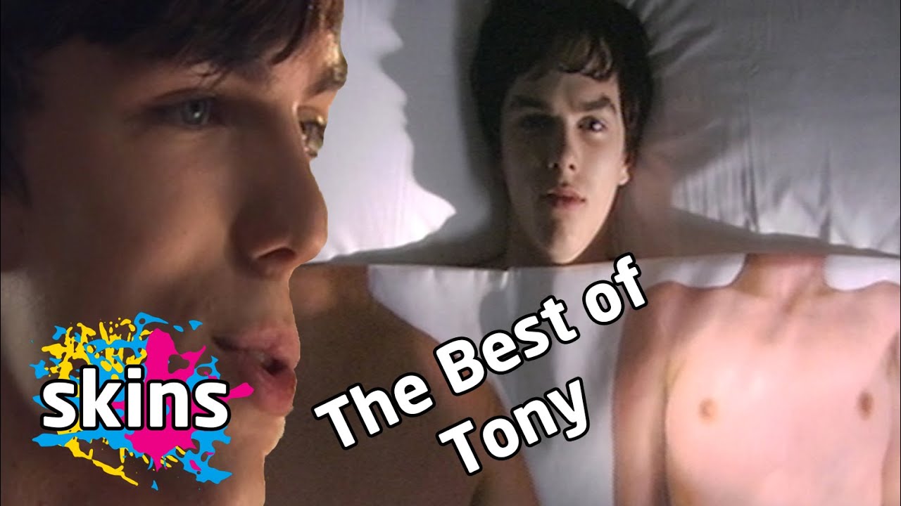 The Best Of Tony - Series 1 - Skins