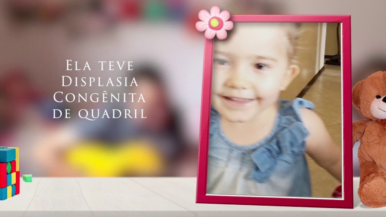 Displasia Congênita de Quadril