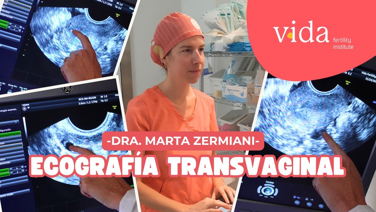 ECOGRAFÍA TRANSVAGINAL: Conteo de folículos antrales y grosor del endometrio