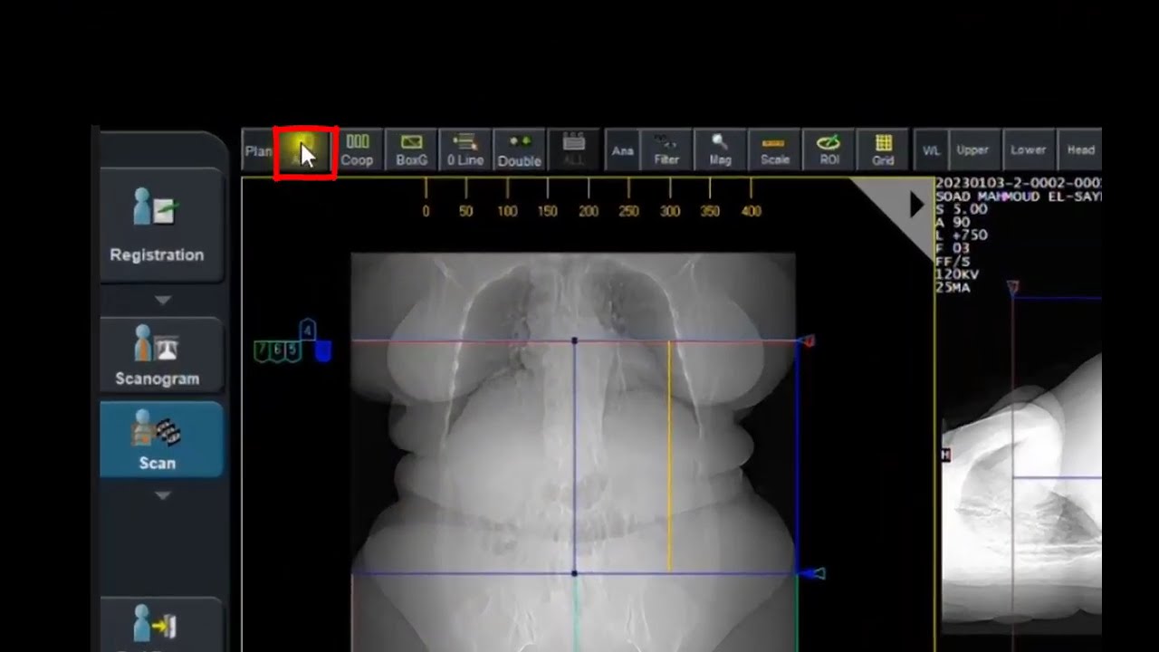 Performing a triphasic liver exam on Fujifilm CT 16 Slice