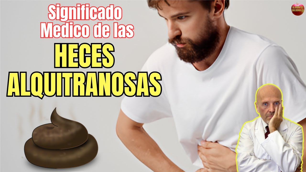 🆘 SIGNIFICADO DE LAS HECES ALQUITRANOSAS O MELENAS ¿QUE HACER SI TIENES HECES MUY NEGRAS? 🆘
