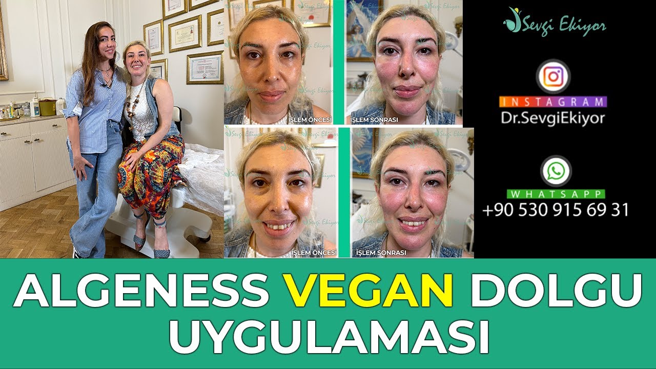 Algeness Vegan Dolgu Uygulaması