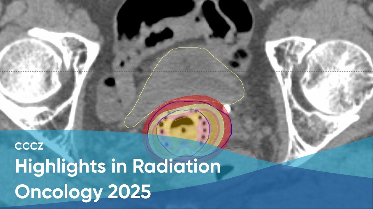 Highlights in Radiation Oncology 2025