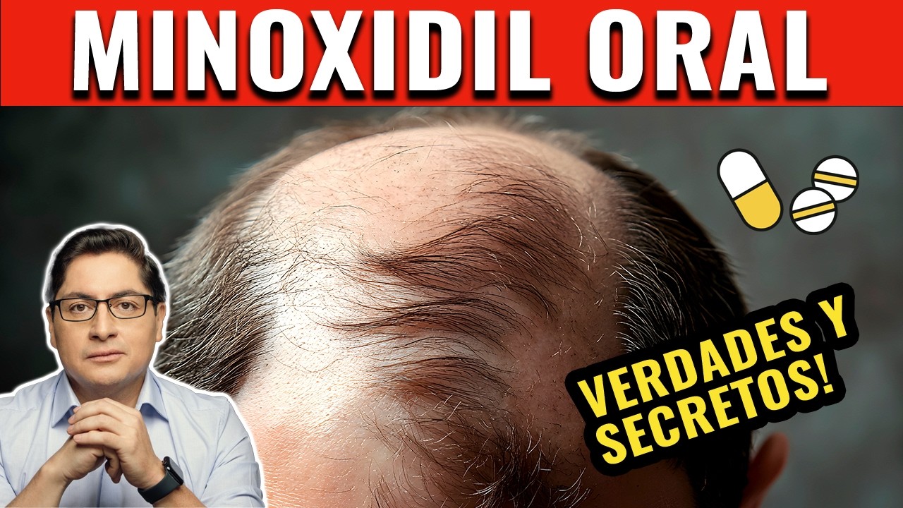 🔴 MINOXIDIL ORAL. Dermatólogo explica Beneficios y Riesgos de su Uso Contra la ALOPECIA 🩺💊