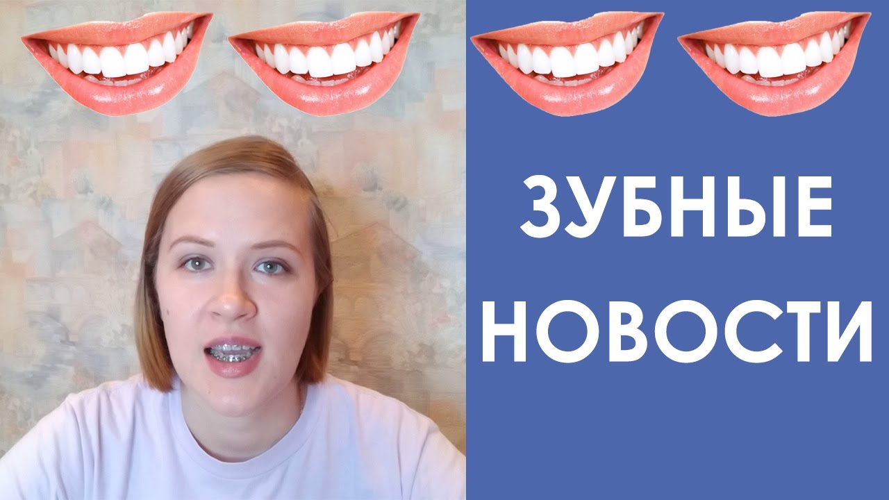 ЗУБНЫЕ НОВОСТИ. Выпуск 1